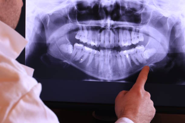 Best Emergency Dental Care for Sports Injuries in Harveys Lake, PA